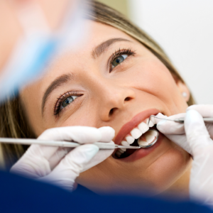 Igiene e Sbiancamento Dentale